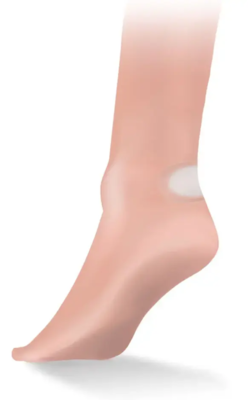 Lifesystems - Blister Plasters (6-pack)